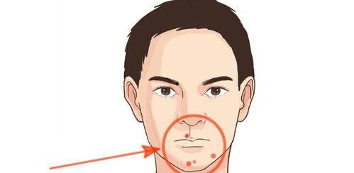 吃瓜会起眼屎吗视频讲解